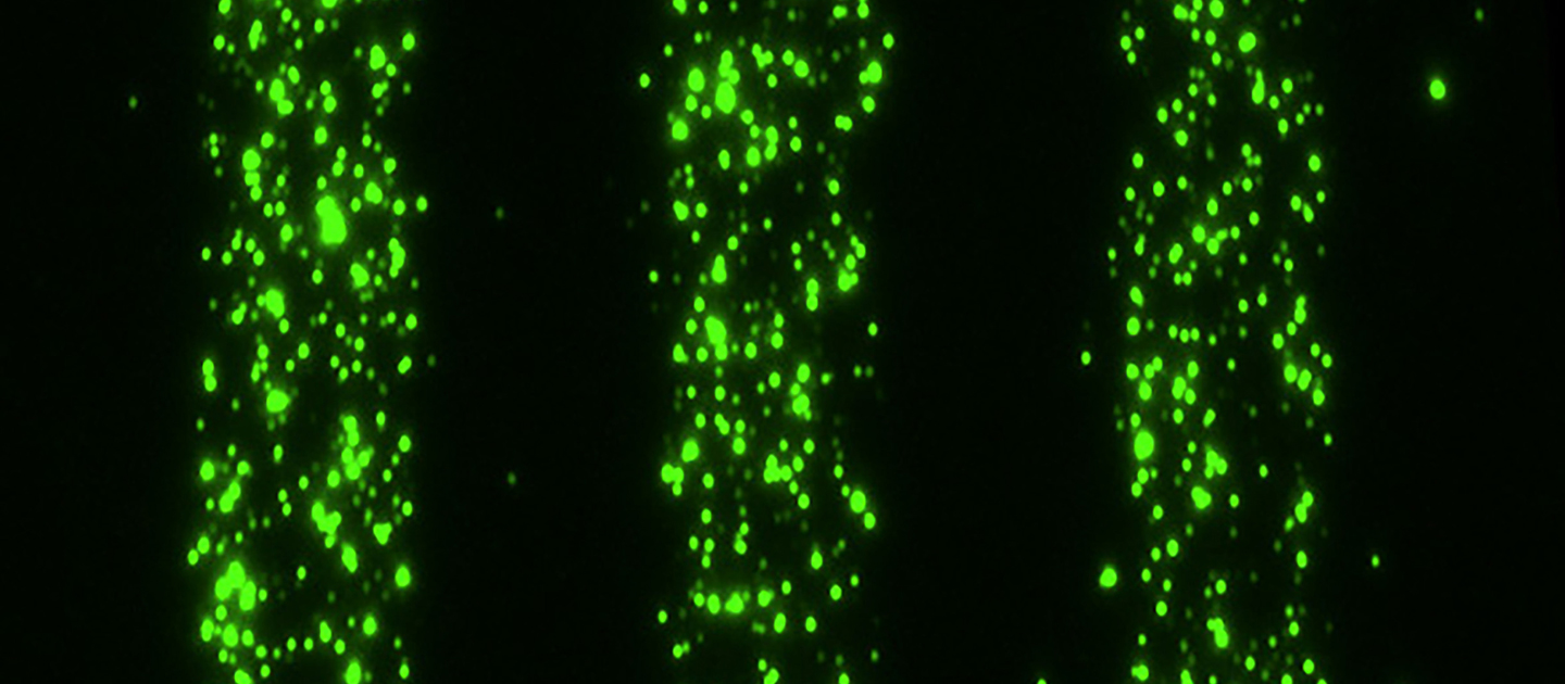 This image shows extracellular vesicles binding to the surface, creating trails about 10 microns wide.